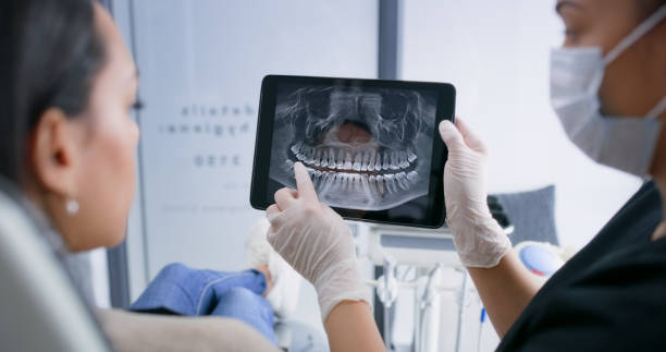Licensed Wisdom Tooth Removal service in Five Points, OH - Smile Center Dentistry
